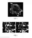 Fig. 02 - ANT4 INHIBITOR COMPOUNDS AND METHODS OF USE THEREOF