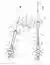 Fig. 02 - Expandable brachytherapy apparatus and methods for using them