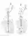 Fig. 07 - Expandable brachytherapy apparatus and methods for using them