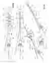Fig. 08 - Expandable brachytherapy apparatus and methods for using them