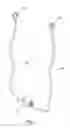 Fig. 02 - Method for soft tissue anchoring with introducer