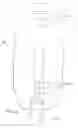Fig. 04 - Method for soft tissue anchoring with introducer