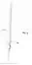 Fig. 06 - Method for soft tissue anchoring with introducer