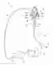 Fig. 01 - Illumination unit, endoscope having illumination unit and illumination probe having illumination unit which is inserted into endoscopic channel