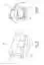 Fig. 02 - Methods and devices for treating sleep apnea