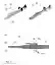 Fig. 07 - DEVICE AND METHOD FOR EARLY DIAGNOSIS AND PROGNOSIS OF HEALING PROGRESSIONS, IN PARTICULAR FOR BONE INJURIES