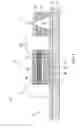 Fig. 02 - Motion artifact rejection microelectrode