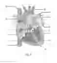 Fig. 07 - Method, implantable medical device, and system for determining the condition of a heart valve