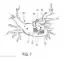 Fig. 07 - IMAGING APPARATUS FOR IMAGING A HEART