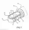Fig. 08 - Vacuum-stabilized ablation system