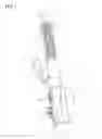 Fig. 02 - MASSAGE DEVICE WITH MAGNETIC FIELD EFFECT CONTROL CAPABILITIES