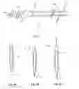 Fig. 02 - Syrinx cavity shunt device and method