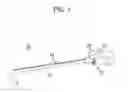 Fig. 02 - Rail-guided epidural-spinal needle