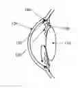 Fig. 01 - Pulsed Electric Field Probe for Glaucoma Surgery