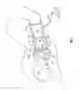 Fig. 02 - Birthing glove