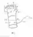 Fig. 04 - Birthing glove