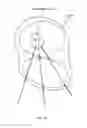 Fig. 131 - Robotic catheter system