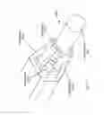 Fig. 147 - Robotic catheter system