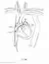 Fig. 158 - Robotic catheter system