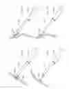 Fig. 167 - Robotic catheter system