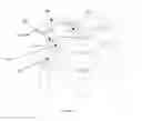 Fig. 45 - Robotic catheter system