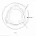 Fig. 87 - Robotic catheter system