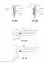 Fig. 90 - Clip applier and methods of use
