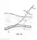 Fig. 06 - DEVICES, METHODS AND KITS FOR FORMING TRACTS IN TISSUE