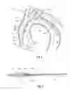 Fig. 02 - Thoracic introducer