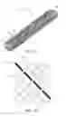 Fig. 02 - External stent