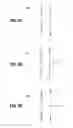 Fig. 05 - DYNAMICALLY ADJUSTABLE SUTURE AND CHORDAE TENDINAE