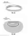 Fig. 10 - DYNAMICALLY ADJUSTABLE SUTURE AND CHORDAE TENDINAE