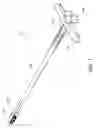 Fig. 02 - Percutaneous arthrodesis method and system