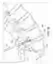 Fig. 07 - Percutaneous arthrodesis method and system