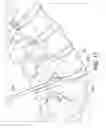 Fig. 08 - Percutaneous arthrodesis method and system