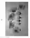 Fig. 02 - Nectarine tree named 'Cakepearl'