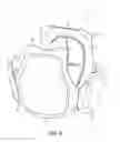 Fig. 10 - Body Armor Protection System