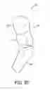 Fig. 31 - Body Armor Protection System