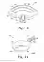 Fig. 10 - Auto contour handle apparatus