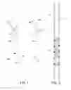 Fig. 02 - ASYNCHRONOUSLY VIBRATING DEVICE FOR USE WITH FOOTWEAR AND METHODS OF USE