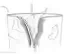 Fig. 01 - REUSABLE PLANT CONTAINER APPARATUS
