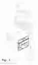 Fig. 02 - Transparent handbag