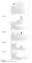 Fig. 07 - ORGANIC EL DISPLAY PANEL AND METHOD FOR MANUFACTURING SAME