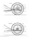 Fig. 07 - Device of human conveyance