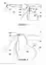 Fig. 02 - Hearing device connector for eye glasses