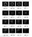 Fig. 07 - Apparatus and method of generating nearly non-diffracting beams from multimode optical fibers