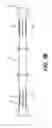 Fig. 08 - System, apparatus, and method for supporting a vehicle for underbody servicing