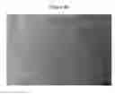 Fig. 06 - Magnesium-based alloy with superior fluidity and hot-tearing resistance and manufacturing method thereof
