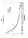 Fig. 09 - Treating flammable materials