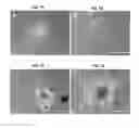 Fig. 07 - Differentiation of stem cells into dopaminergic cells